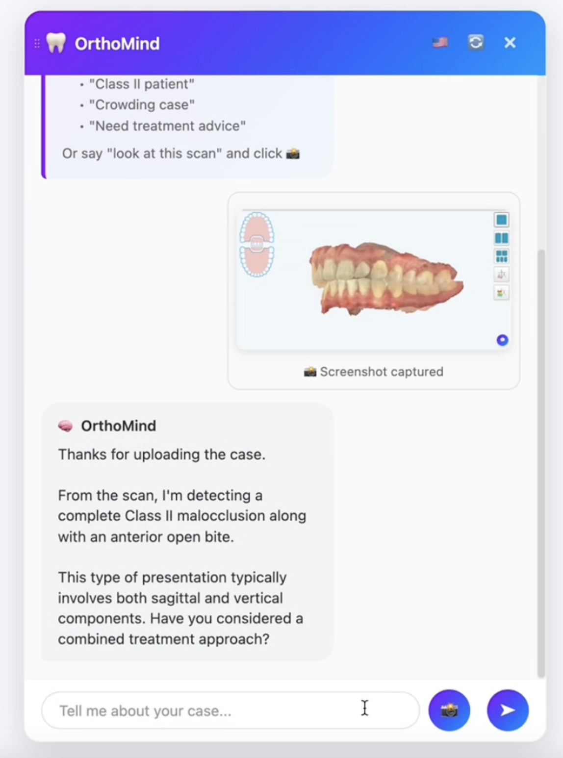 OrthoMind smart vision analysis showing 3D dental scan analysis with Class II malocclusion detection and professional treatment recommendations